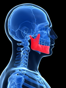 What is Orthognatic Surgery