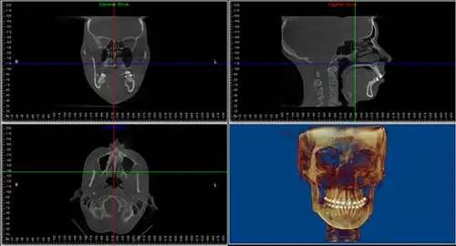 3D image for Oral Surgery